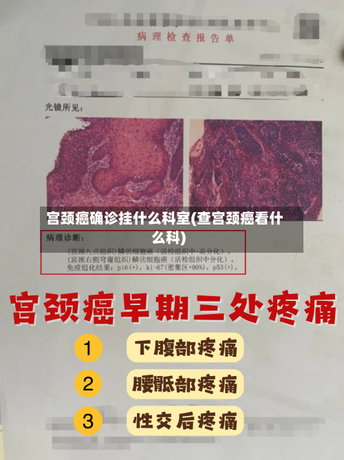 宫颈癌确诊挂什么科室(查宫颈癌看什么科)-第3张图片
