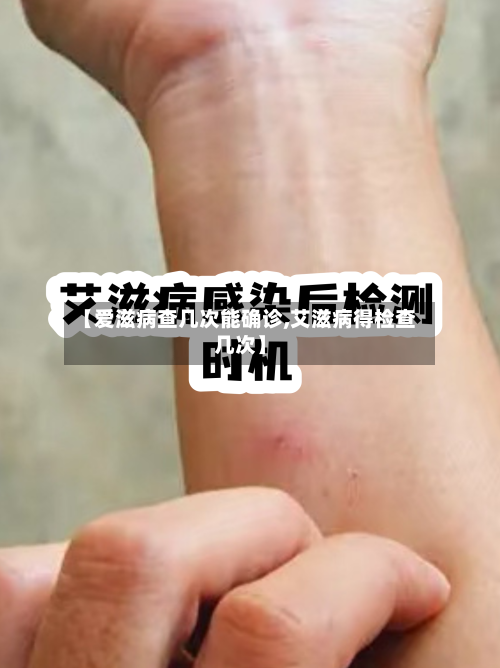 【爱滋病查几次能确诊,艾滋病得检查几次】
