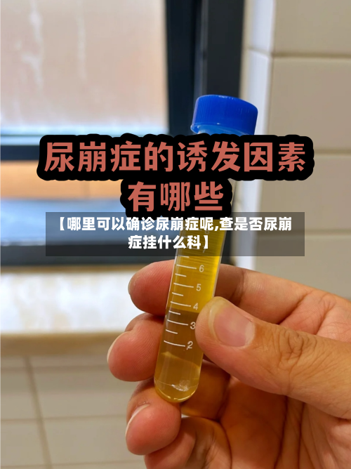 【哪里可以确诊尿崩症呢,查是否尿崩症挂什么科】