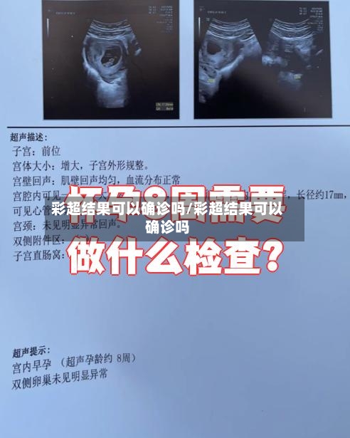 彩超结果可以确诊吗/彩超结果可以确诊吗