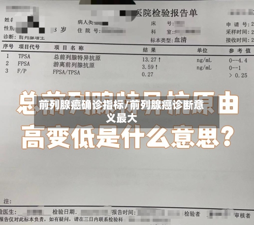 前列腺癌确诊指标/前列腺癌诊断意义最大-第2张图片