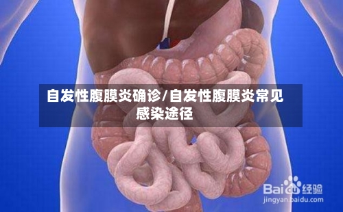 自发性腹膜炎确诊/自发性腹膜炎常见感染途径-第2张图片