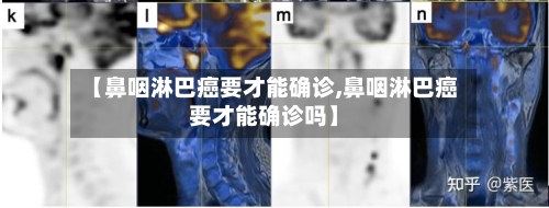 【鼻咽淋巴癌要才能确诊,鼻咽淋巴癌要才能确诊吗】-第3张图片