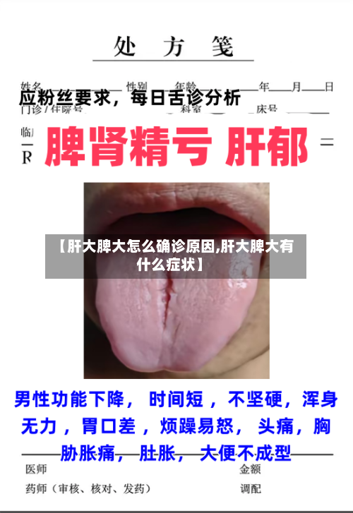 【肝大脾大怎么确诊原因,肝大脾大有什么症状】-第3张图片