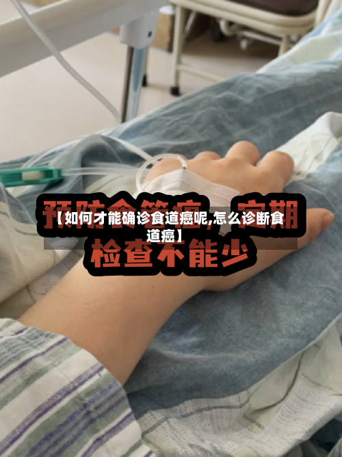 【如何才能确诊食道癌呢,怎么诊断食道癌】-第3张图片