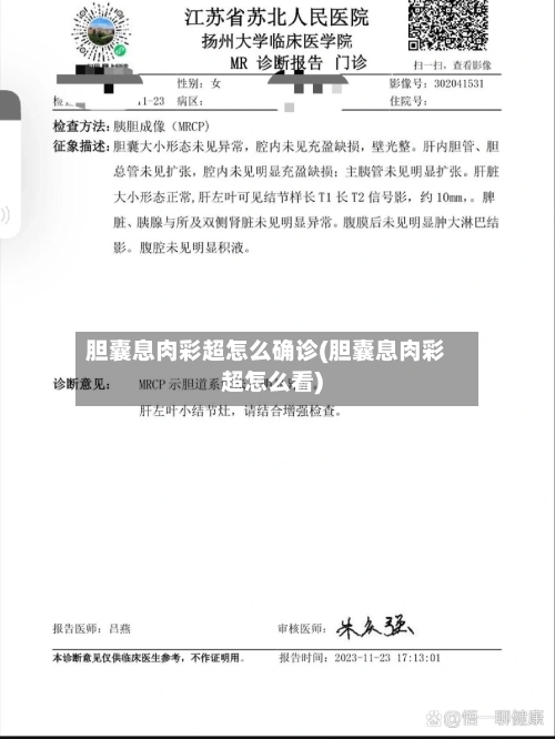 胆囊息肉彩超怎么确诊(胆囊息肉彩超怎么看)
