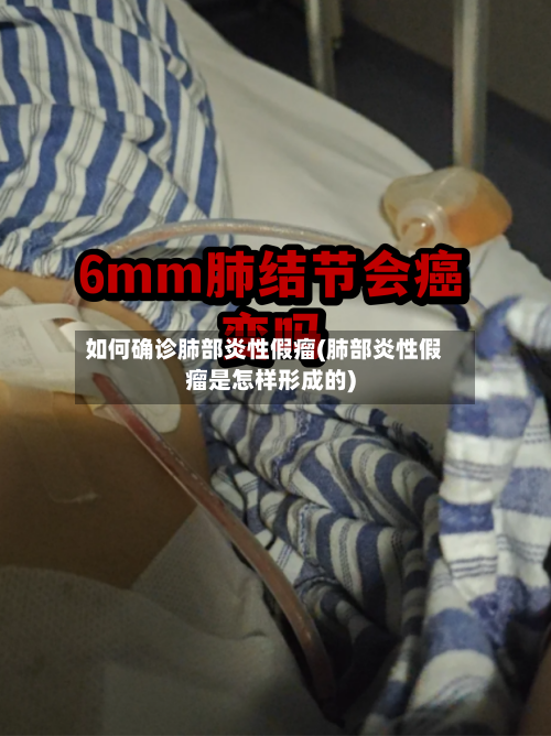 如何确诊肺部炎性假瘤(肺部炎性假瘤是怎样形成的)