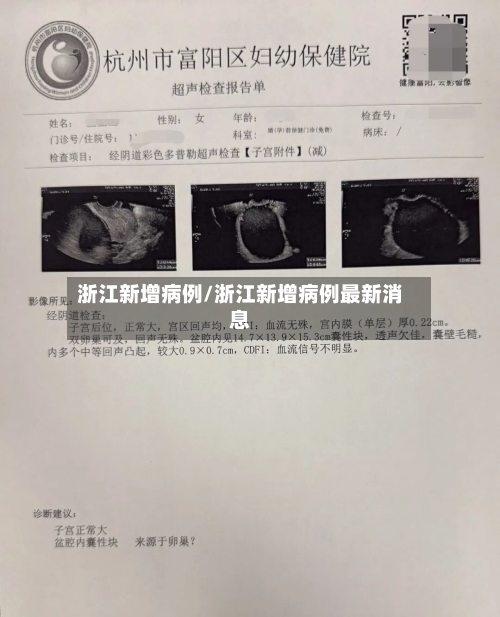 浙江新增病例/浙江新增病例最新消息-第2张图片