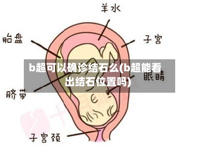 b超可以确诊结石么(b超能看出结石位置吗)
