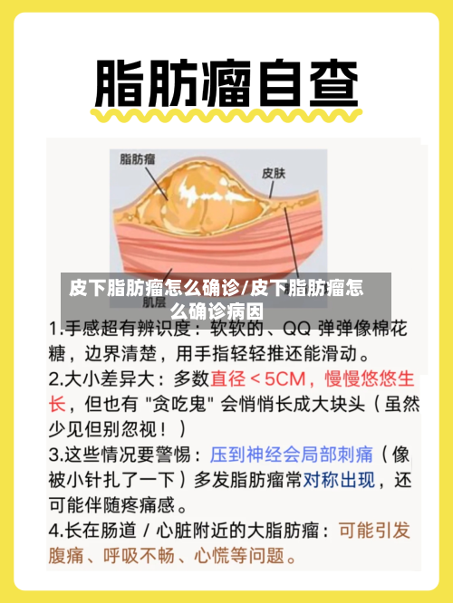 皮下脂肪瘤怎么确诊/皮下脂肪瘤怎么确诊病因-第2张图片