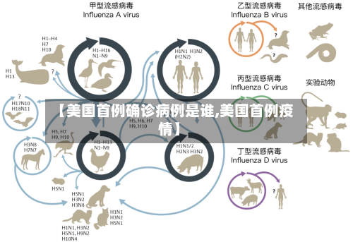 【美国首例确诊病例是谁,美国首例疫情】-第2张图片