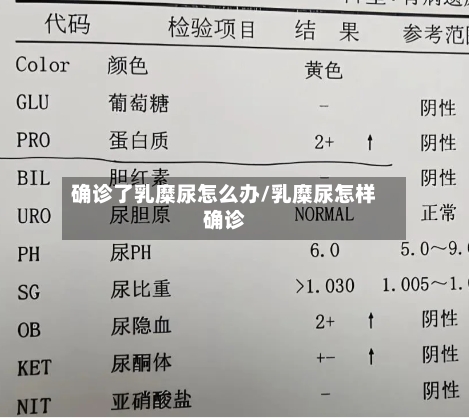 确诊了乳糜尿怎么办/乳糜尿怎样确诊