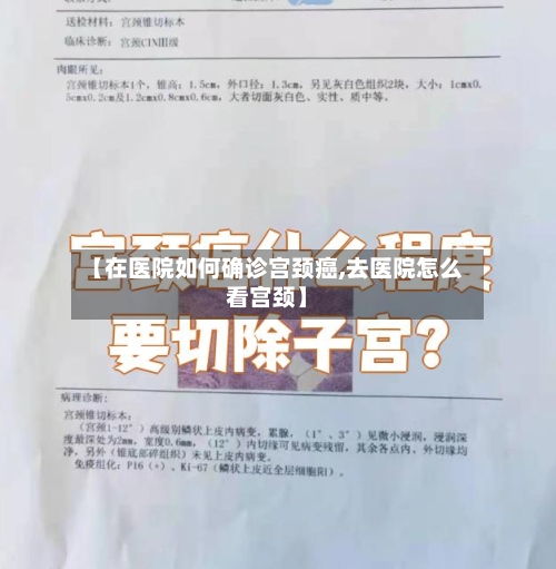 【在医院如何确诊宫颈癌,去医院怎么看宫颈】-第3张图片
