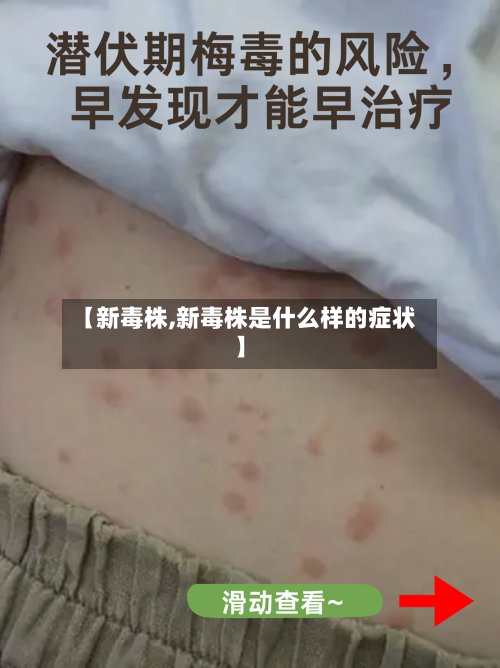 【新毒株,新毒株是什么样的症状】-第2张图片