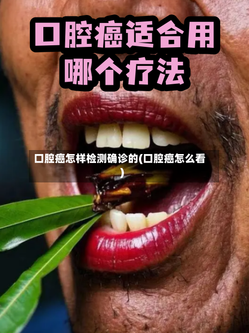 口腔癌怎样检测确诊的(口腔癌怎么看)-第2张图片