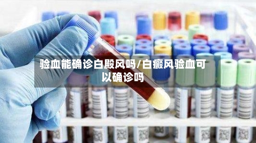 验血能确诊白殿风吗/白癜风验血可以确诊吗-第2张图片